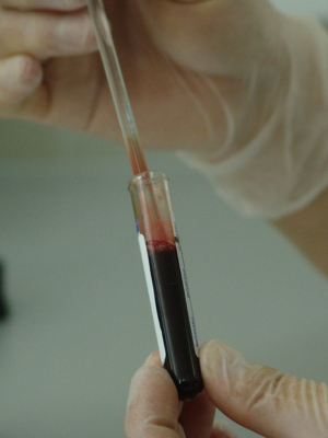 The Advancements of Nanomedicine & Cancer Research