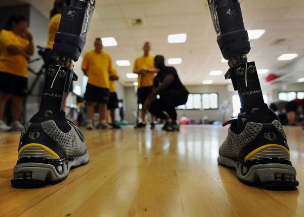 How Magnets Are Used In Prosthetics