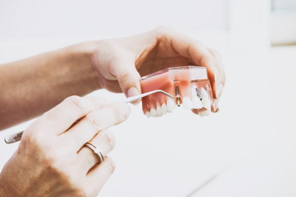 The Use of Magnets in Prosthodontics