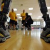 How Magnets Are Used In Prosthetics
