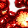 Google X Wants To Beat Diseases With Magnetic Nanoparticles