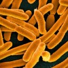 What Is Magnetotactic Bacteria?